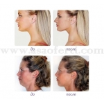 Масажор за брадичка Neckline Slimmer